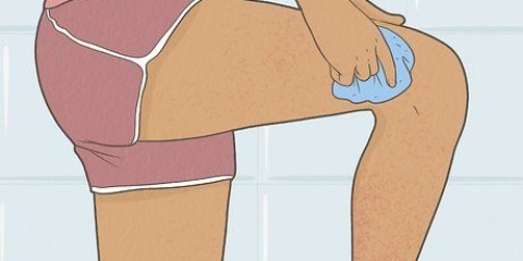 Sbarazzati rapidamente delle bruciature da rasoio