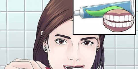 Sbiancamento dei denti con perossido di idrogeno