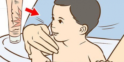 Trattare un'eruzione cutanea sul collo del tuo bambino