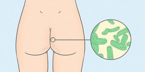 Sbarazzati dell'acne sui glutei
