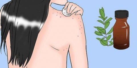 Sbarazzati dell'acne sul tuo corpo