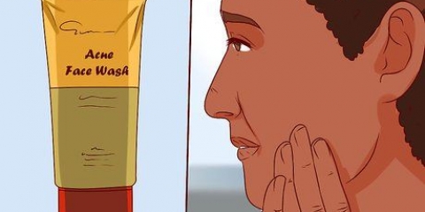 Sbarazzati di un brufolo con il gel di aloe vera