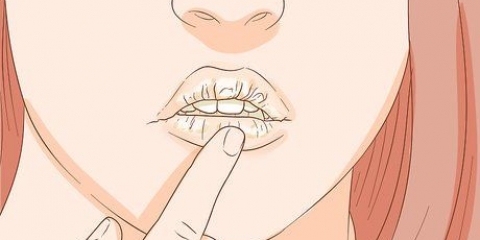 Come sbarazzarsi di una ghiandola salivare ostruita