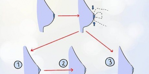 Sbarazzarsi dei capezzoli invertiti