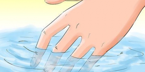 Come sbarazzarsi dell'eruzione cutanea da edera velenosa