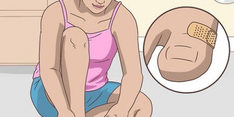 Trattare le vesciche ai piedi
