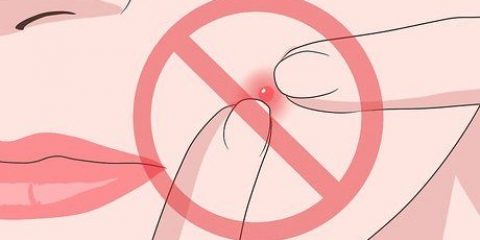 Prevenire lo sviluppo di un brufolo