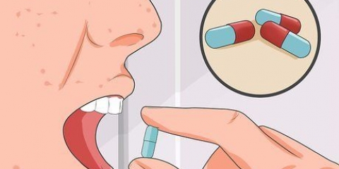 Curare la varicella