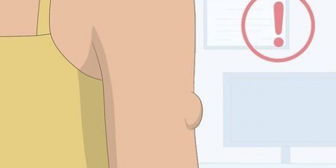Sapere se hai un lipoma
