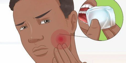 Sapere quando è necessario sostituire le otturazioni dentali