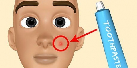 Crea il tuo trattamento per l'acne