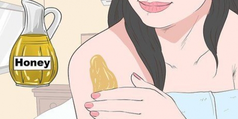 Assicurati che una puntura di zanzara non pruda più