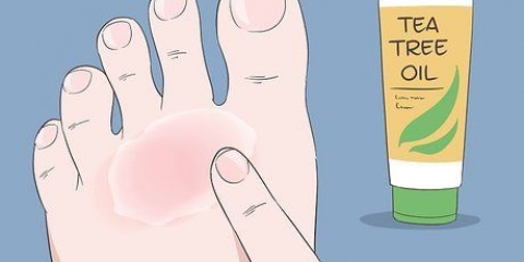 Curare l'eczema del nuotatore: si può fare naturalmente?
