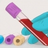 Aumento della velocità di filtrazione glomerulare