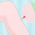 Rimuovere i peli spessi delle gambe