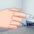 Trattare un'unghia incarnita