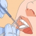 Trattare un dente sciolto