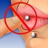 Pulizia di un piercing