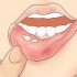 Riconoscere l'herpes