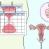 Preparare il tuo corpo per la gravidanza dopo un aborto spontaneo