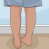 Rimuovi le cicatrici dalle gambe