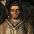 Licantropia curativa in skyrim