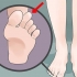 Affrontare il piede greco (sindrome di morton)