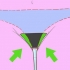 Rimuovere i peli pubici intorno alla vagina