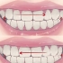 Smetti di digrignare i denti nel sonno