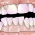 Rimuovere la placca dentale